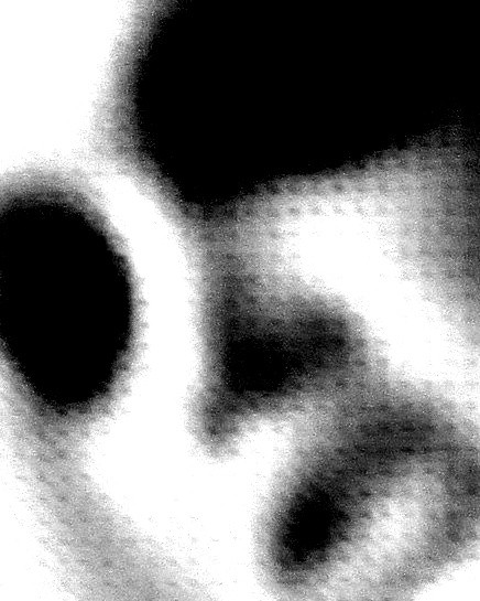 Bug, digital photograph by Greg Yenoli